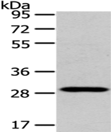 Anti-TXNL1 Antibody Anti-TXNL1 Antibody