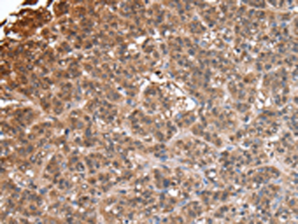 Anti-IMPA1 Antibody Anti-IMPA1 Antibody