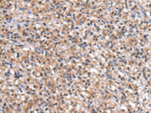 Anti-IMPA1 Antibody Anti-IMPA1 Antibody