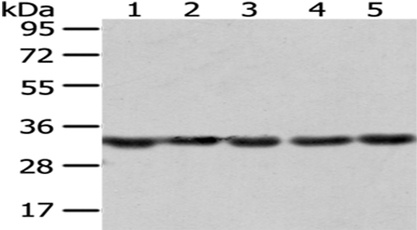 Anti-SNRPA Antibody