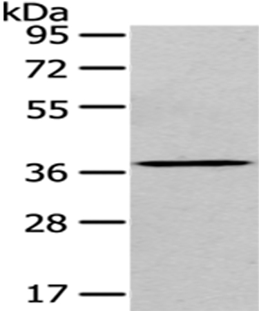 Anti-EIF3I Antibody