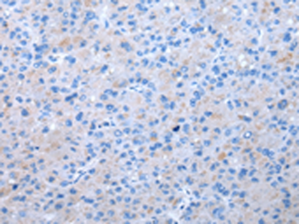 Anti-EIF3I Antibody Anti-EIF3I Antibody