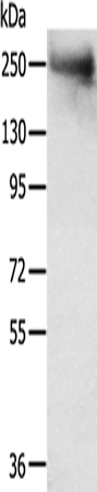 Anti-TACC2 Antibody