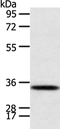 Anti-CALB2 Antibody