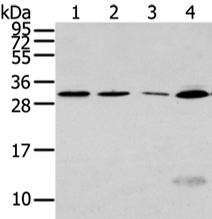 Anti-SIAH1 Antibody