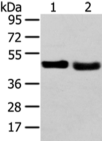 Anti-TRIB2 Antibody
