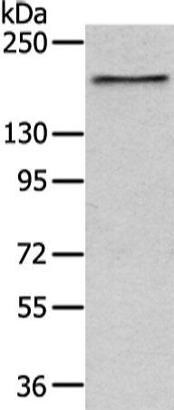 Anti-USP47 Antibody