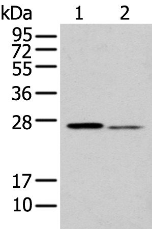 Anti-GSTM2 Antibody