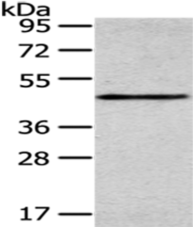 Anti-SMYD2 Antibody