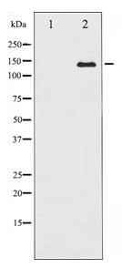 Anti-Calcium Sensing Receptor Antibody