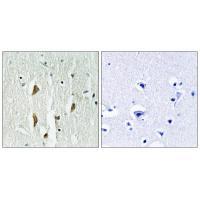 Anti-PAK1 / 2 / 3 (Ab-423 / 402 / 421) Antibody