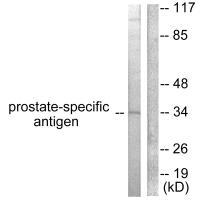 Anti-Prostate-specific Antigen Antibody