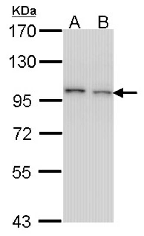 Anti-EPS8 Antibody
