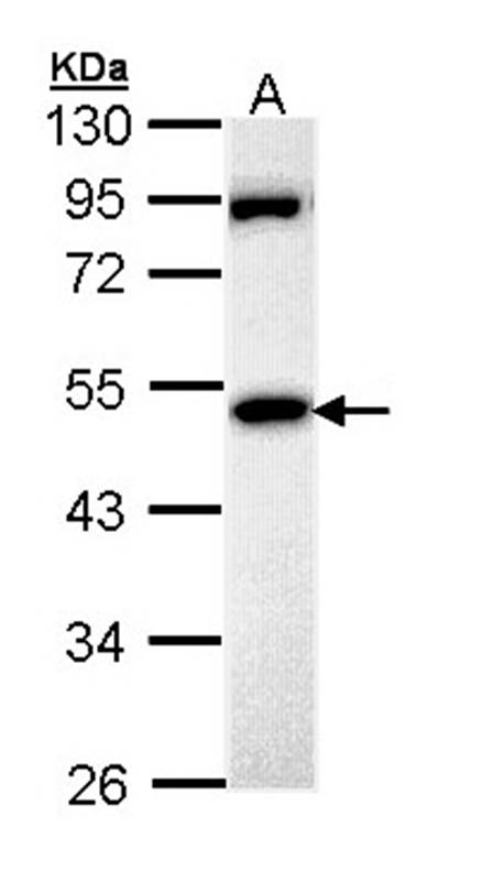 Anti-MPP1 Antibody