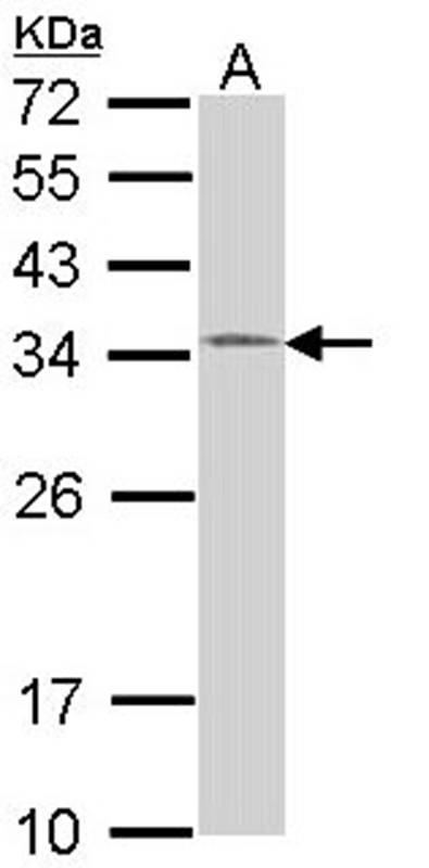Anti-HUS1 Antibody