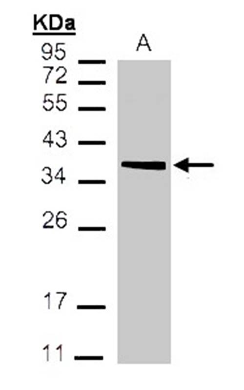 Anti-MDH2 Antibody