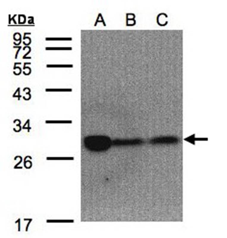 Anti-ClpP Antibody