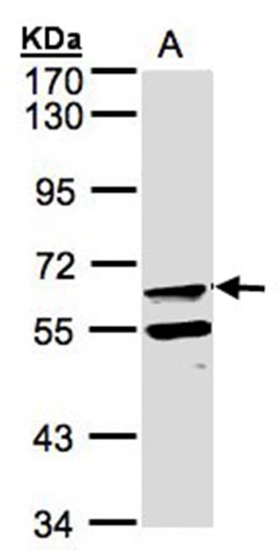 Anti-FPGT Antibody