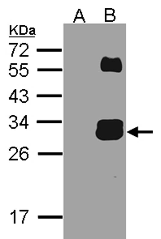 Anti-KLK7 Antibody