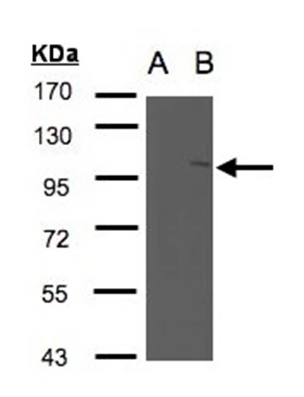 Anti-FAN Antibody