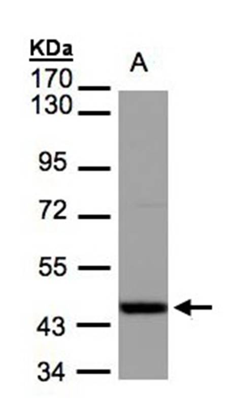 Anti-IDH2 Antibody
