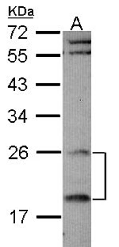 Anti-RGS4 Antibody