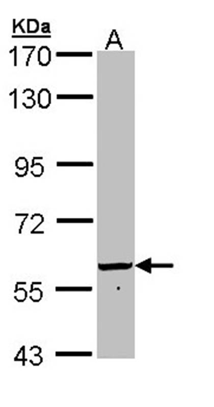 Anti-FTCD Antibody