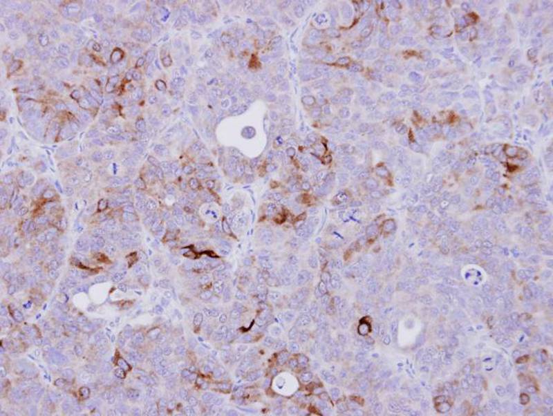 Anti-CD74 Antibody Anti-CD74 Antibody