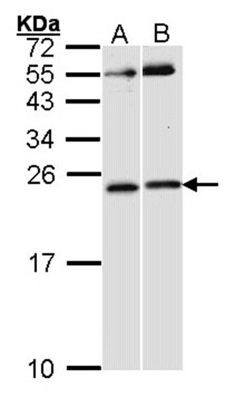 Anti-RAC1 Antibody