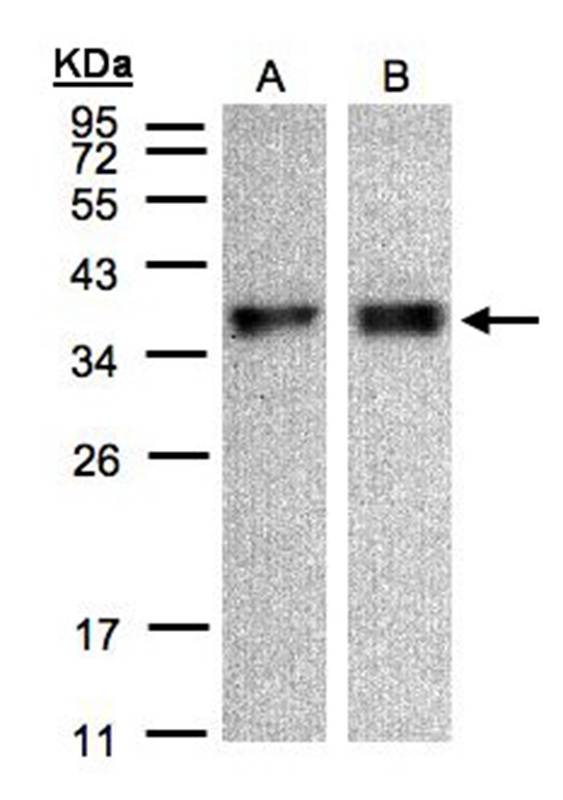 Anti-ZPBP Antibody