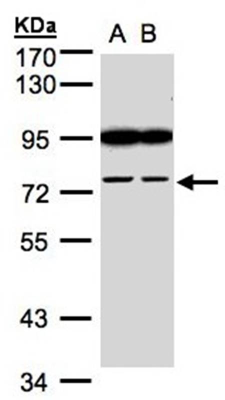 Anti-FSD2 Antibody
