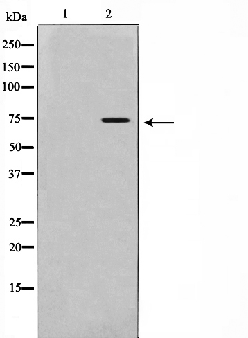 Anti-IL2R Antibody