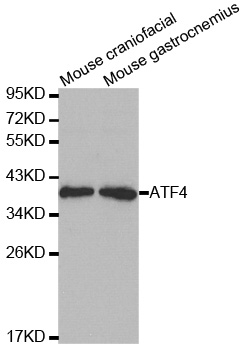 Anti-ATF4 Antibody