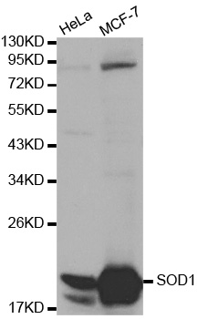 Anti-SOD1 Antibody