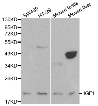 Anti-IGF1 Antibody