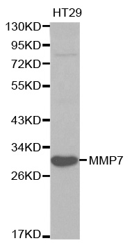 Anti-MMP7 Antibody