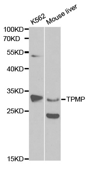 Anti-TPMT Antibody