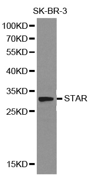 Anti-STAR Antibody