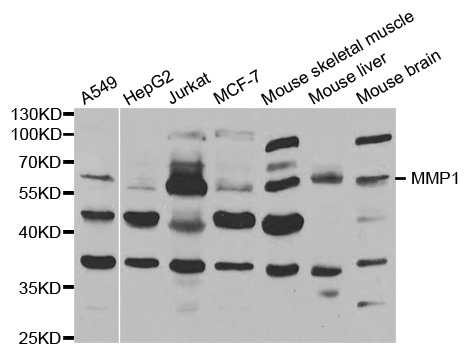 Anti-MMP1 Antibody