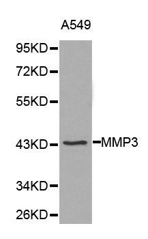 Anti-MMP3 Antibody