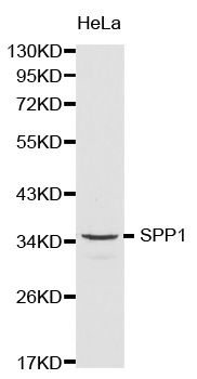 Anti-SPP1 Antibody