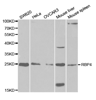 Anti-RBP4 Antibody