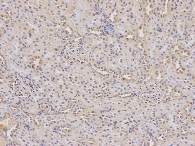 Anti-DHFR Antibody Anti-DHFR Antibody