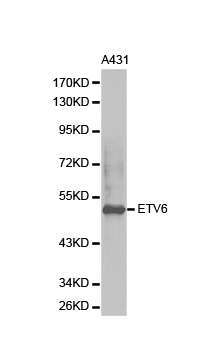 Anti-ETV6 Antibody