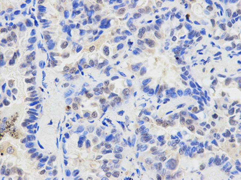 Anti-ETV6 Antibody Anti-ETV6 Antibody