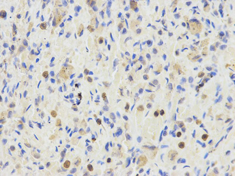 Anti-ETV6 Antibody Anti-ETV6 Antibody