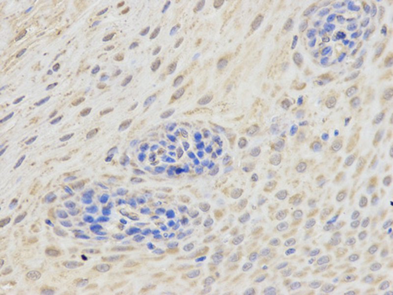 Anti-ETV6 Antibody Anti-ETV6 Antibody