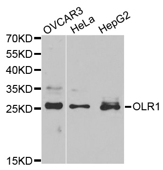 Anti-OLR1 Antibody