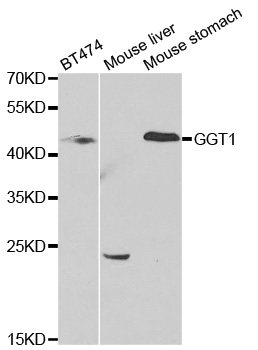 Anti-GGT1 Antibody