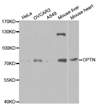 Anti-OPTN Antibody